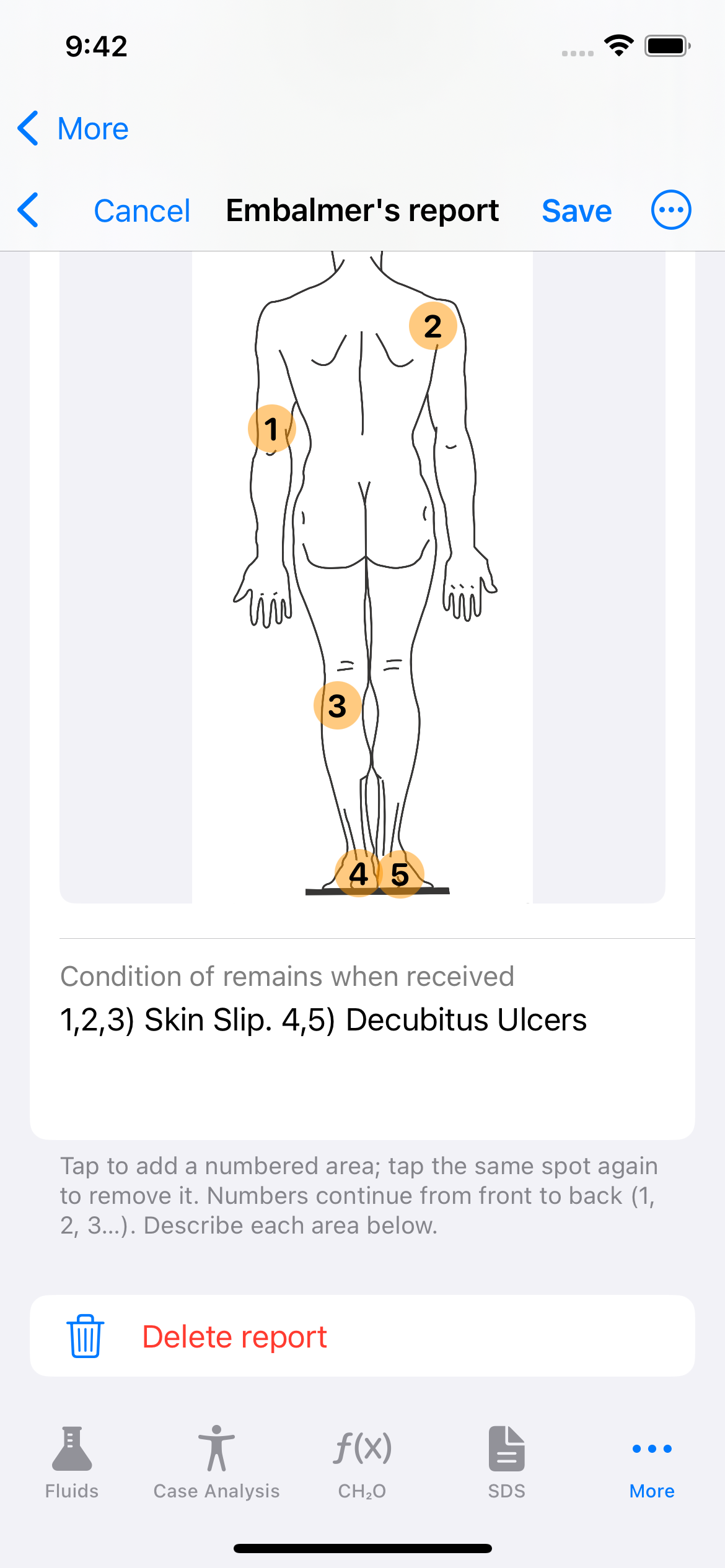 Embalming Log Overview